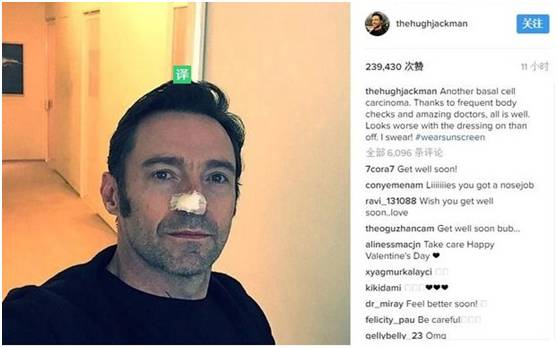 痣未结痂要擦药吗,痣没去干净会有影响吗