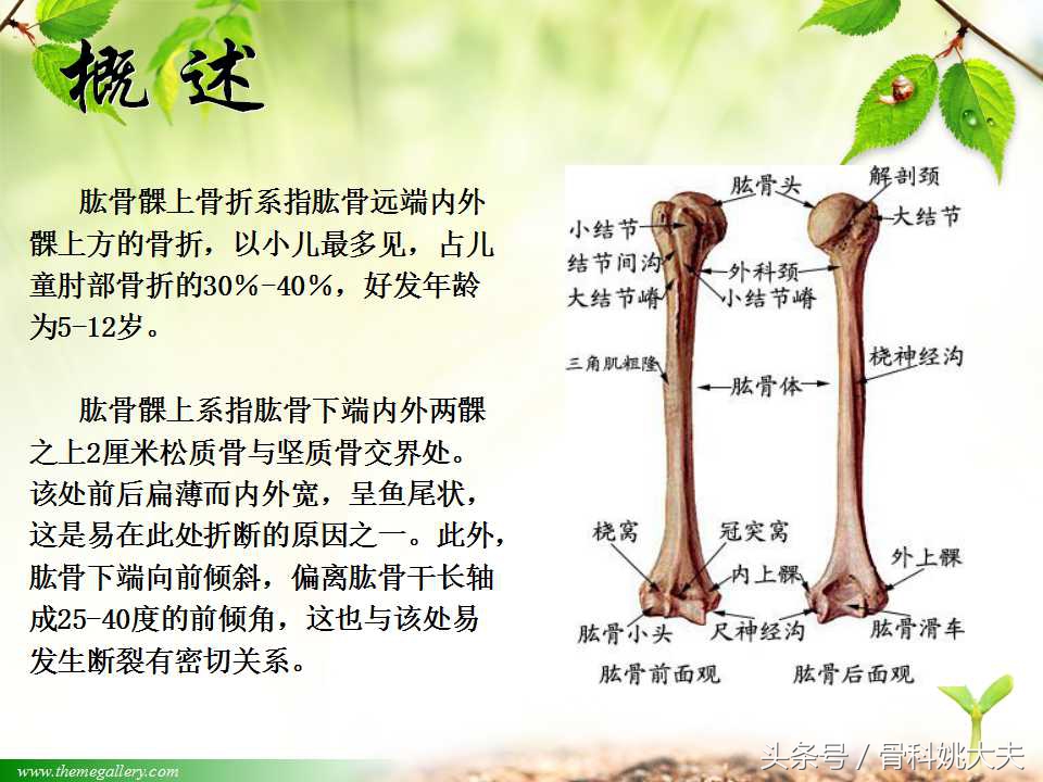 儿童肱骨干骨折处理方法,小孩胳膊肱骨骨折恢复最佳的方法