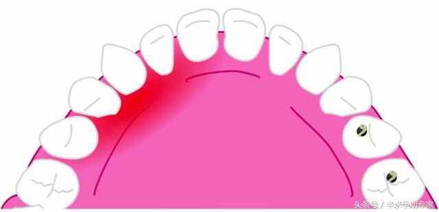 孕期口腔保健图,口腔整形保健