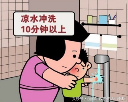 如果在家不小心被烫伤可以怎么办,不小心烫伤要怎么样才可以不烫