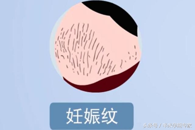 明星怎么保养皮肤,孕期怎样保养皮肤才不会长斑