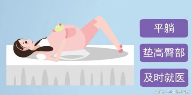 顺产破水来临时，准爸准妈如何应对？