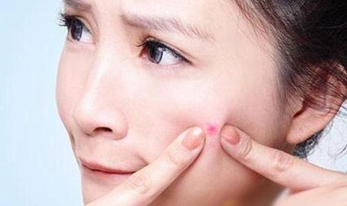 青春期如何祛痘不留痕,痘痘反复长教你一招正确祛痘