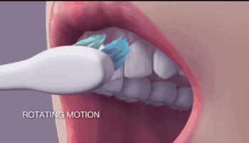 洗牙有什么副作用吗,洗牙怎么不伤牙