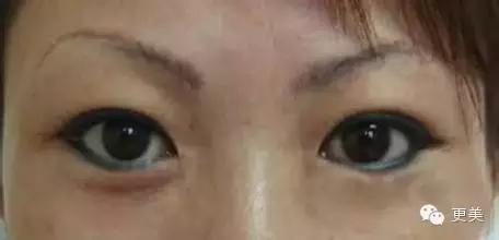 韩式半永久,韩式半永久都有什么