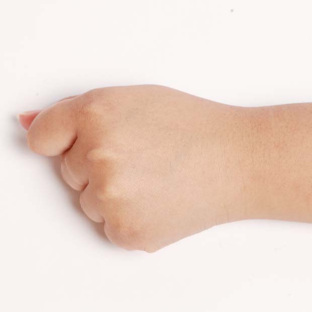 轻松修复痘印告别痘痘肌,有效快速祛痘印