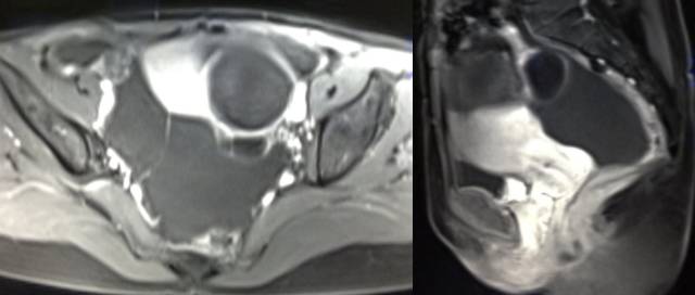 女性下腹疼痛是什么病,女性下腹疼痛的预兆