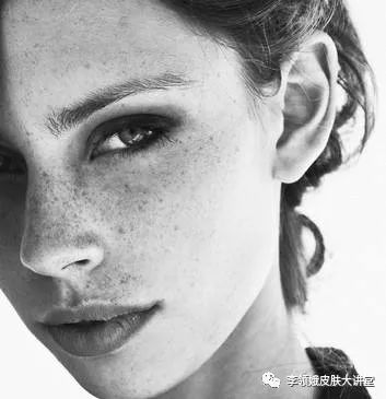 「杏林微科普」异斑异法早知道