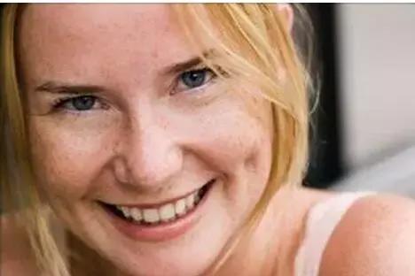 皮肤科医生教你去脸上长斑,皮肤医生讲斑的分类