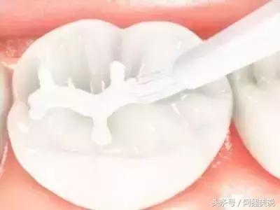 牙齿也有数字密码，解锁你会更健康