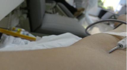 献血发现问题会通知吗,献血就知道病情了吗