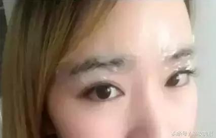 麻药不要敷太厚,眼睛敷麻药过敏