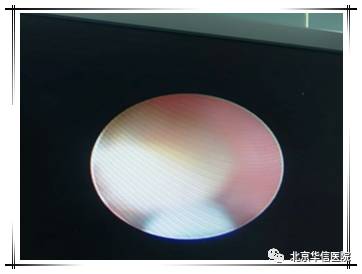 中医男科清道夫,泌尿外科经典案例