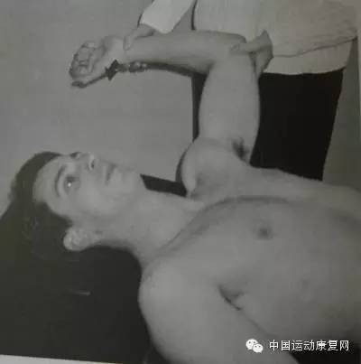 肩峰撞击综合征肩袖损伤怎么治疗,肩峰下撞击综合征导致肩袖损伤