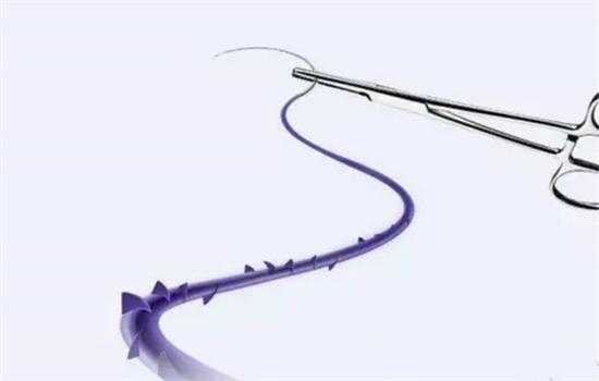 线雕隆鼻是什么意思,线雕隆鼻有什么危害吗有副作用吗