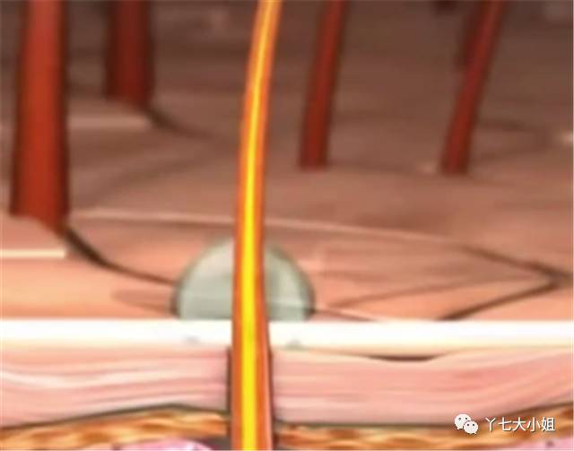 拯救头发稀少掉发有什么新技术,严重掉发头发越来越稀疏不要慌