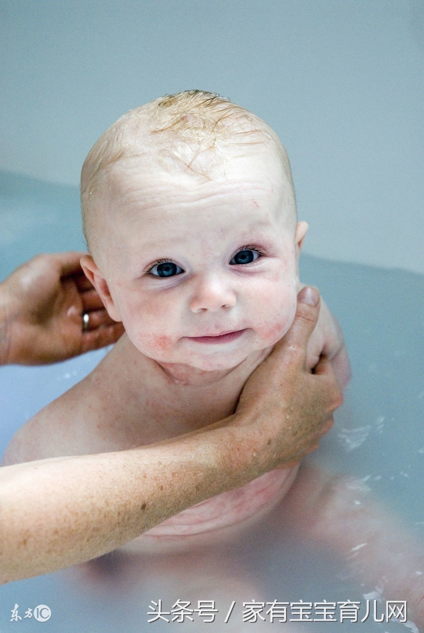 宝宝湿疹用了3种药膏也不见好,宝宝湿疹怎么用激素药膏