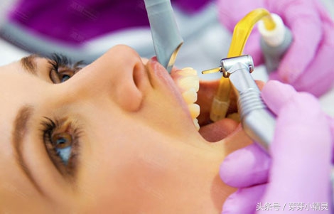 第一次洗牙后牙缝太大了怎么办,为什么洗牙后牙缝越来越大