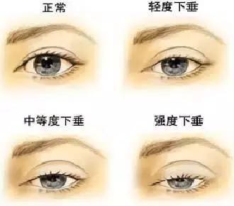 满月的宝宝眼病筛查要做吗,婴儿眼病检查哪些