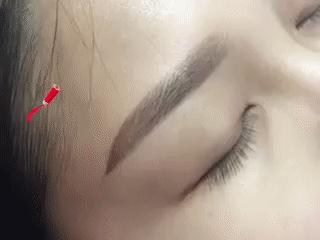 南阳时光整形美容,南阳提眉整形