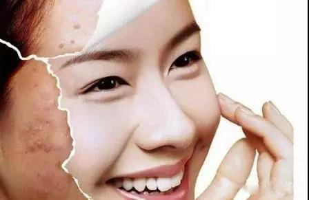 丽人妆容,丽人祛痘祛斑美白祛皱
