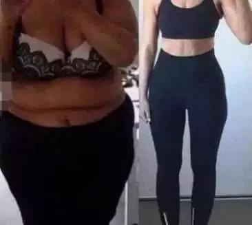 面部吸脂脸部松弛怎么办,肚子吸脂后松弛怎么锻炼