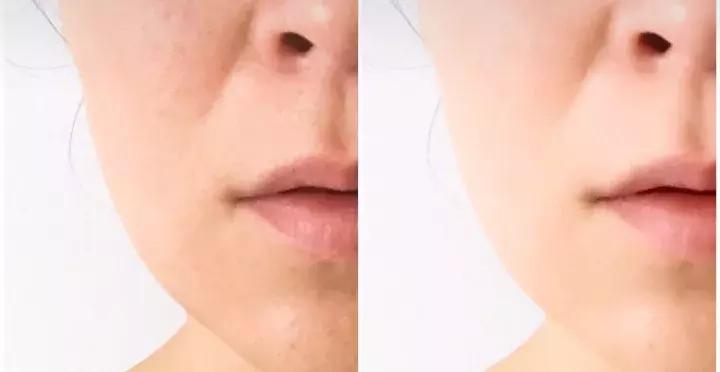 油皮混油皮哪种面霜比较适合,油皮面霜哪个好