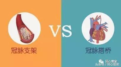 不做支架不搭桥中医调理冠心病,冠心病支架和搭桥的条件