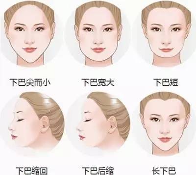 丰下巴用玻尿酸好还是自体脂肪好,玻尿酸丰下巴后要注意哪些问题