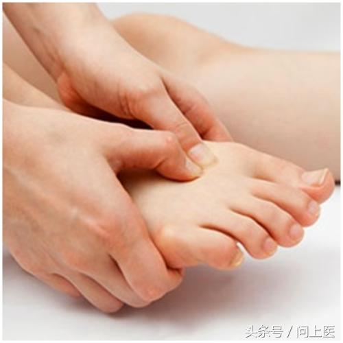 大脚趾关节炎怎么才能好,脚拇指关节炎症状有哪些表现
