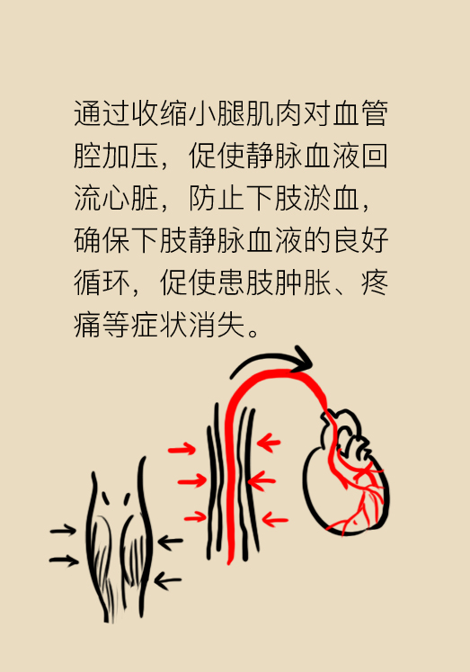 弹力袜对下肢血栓有什么帮助,预防下肢静脉血栓弹力袜注意事项