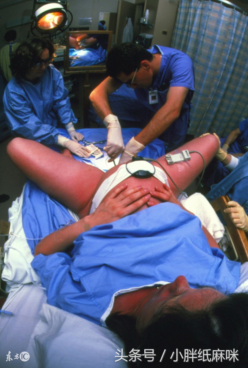 顺产为什么都得侧切,现在真的顺产都侧切吗