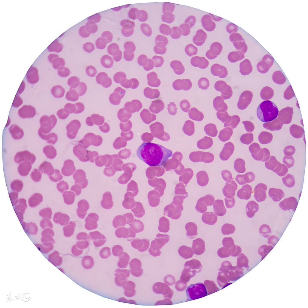 免疫调节概念股票有哪些,bnct疗法概念股票