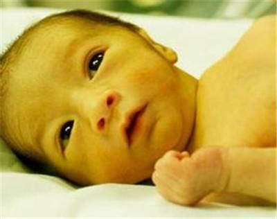 黄疸指数超过15就是病理性黄疸吗,宝宝黄疸偏高宝妈吃什么可以缓解