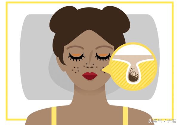 清洁不彻底最贵的护肤品也浪费,清洁不到位再贵的护肤品都白费