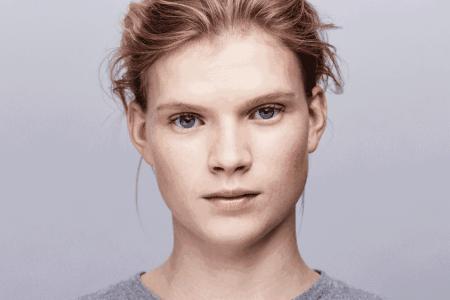 去角质可以改善皮肤暗沉吗,和暗黄肌肤说再见