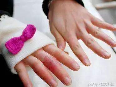 谁说蜂蜜只能用来吃？蜂蜜这9大用途，不知省了多少买药钱！