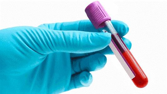 甲功五项能看出来是恶性结节嘛,甲状腺功能检查五项tgab