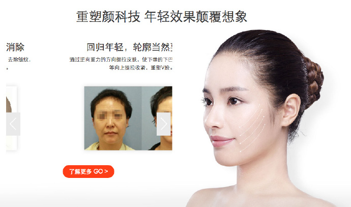 线雕的注意事项和方法,线雕提升讲解视频