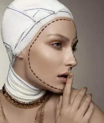 微整形黑幕深扒 (微整形有哪些黑幕)