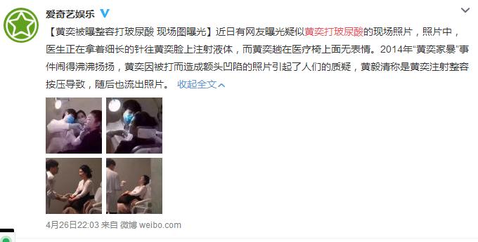 打玻尿酸的明星,为什么明星都要打玻尿酸