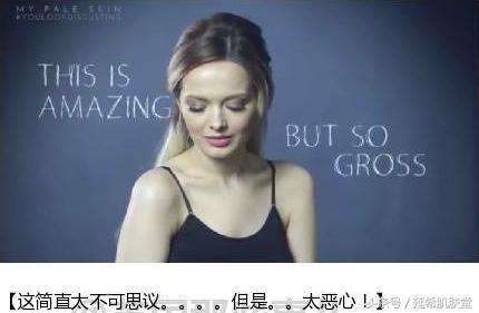 “你如果不长痘一定很好看”——长痘患者的自述