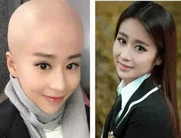 女明星没了刘海变好看了,女明星突然没头发了