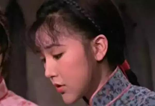 整容失败嘴巴歪斜现状,整容失败鼻梁歪了半年