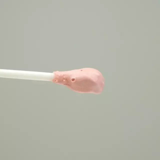 如何防治姨妈前长痘,怎么治疗姨妈痘