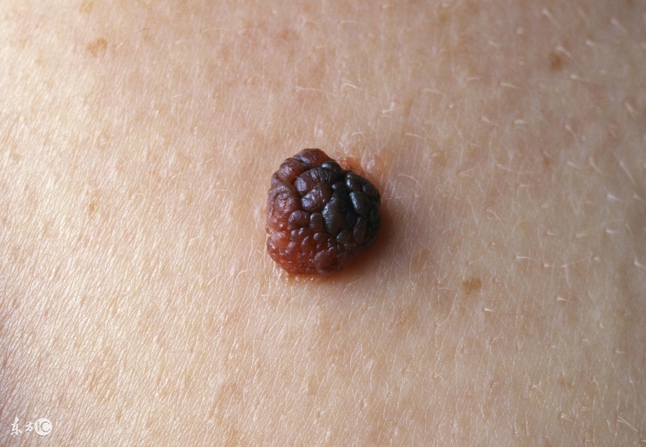 身体内的斑块怎么体检,身体各个部位出现斑块是怎么了