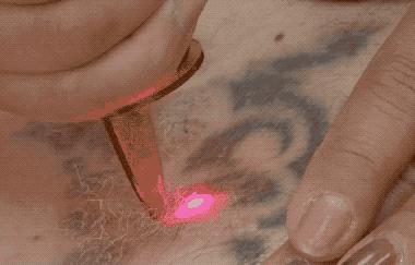 纹身的也是你,洗纹身的也是你!这些动图看完,我都替你疼……