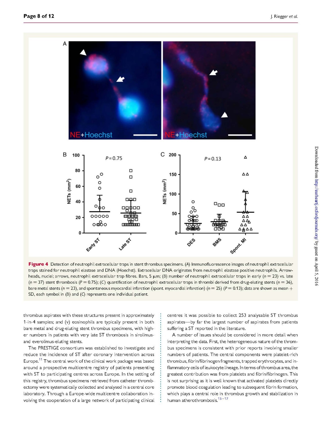支架内血栓怎么处理,支架内血栓的原因及表现