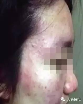 常州被曝光的记者,常州曝光事件