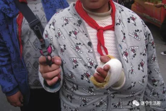 蓬溪一学生耍玩具枪“走火”手烧伤，店主承担一半医疗费